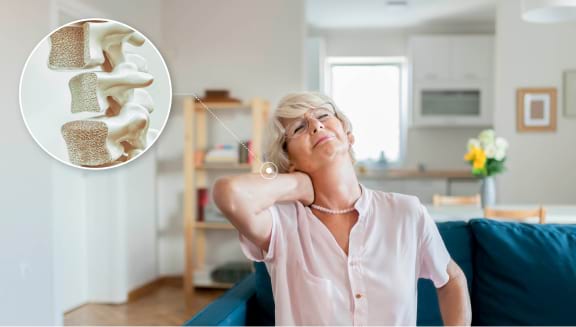 La osteoporosis, una enfermedad crónica